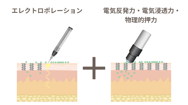 有効成分を肌深層へ「メソポレーション法」